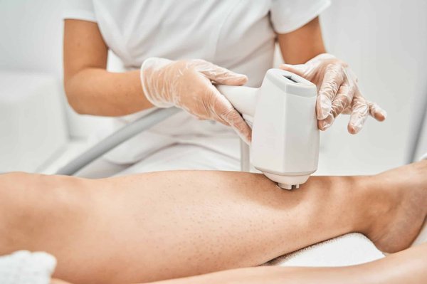 Epilation laser à Marseille : Tout savoir sur les tarifs
